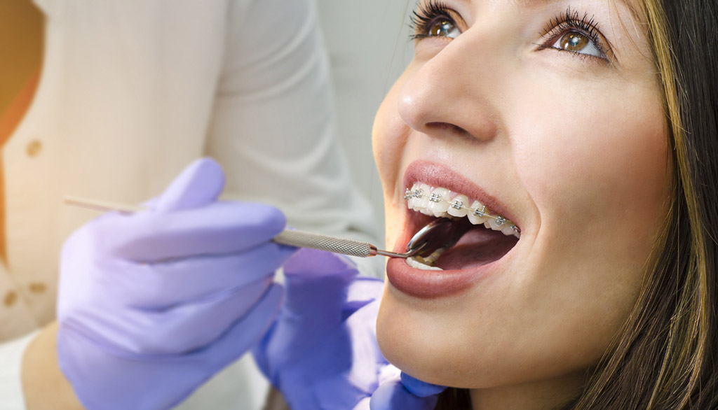 Ortodonzia a Rimini, apparecchi per denti - Studio Dentistico Bianchini